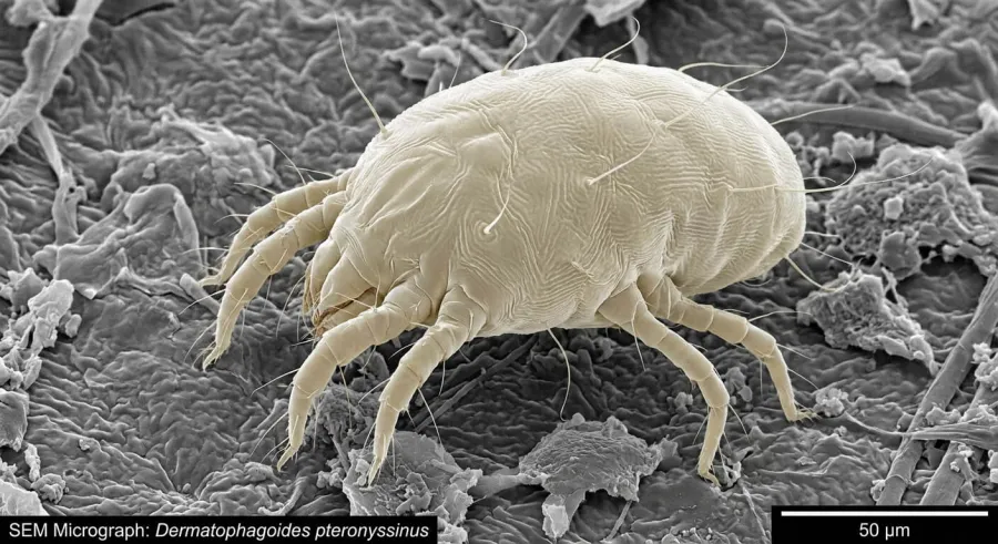 Roztocze kurzu domowego (Dermatophagoides) — niewidoczne gołym okiem, silny alergen